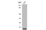Western Blot analysis of A549 cells using Fhit Polyclonal Antibody