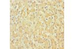 Immunohistochemistry of paraffin-embedded human liver tissue using CSB-PA409861LA01HU at dilution 1:100
