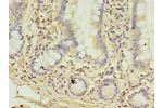 Immunohistochemistry of paraffin-embedded human small intestine tissue using CSB-PA409861YA01HU at dilution of 1:100