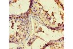 Immunohistochemistry of paraffin-embedded human