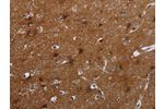 The image on the left is immunohistochemistry of paraffin-embedded Human brain tissue using CSB-PA420988(FMN2 Antibody) at dilution 1/20, on the right is treated with synthetic peptide. (Original magnification: 