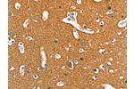The image on the left is immunohistochemistry of paraffin-embedded Human brain tissue using CSB-PA436650(ADD2 Antibody) at dilution 1/15, on the right is treated with fusion protein. (Original magnification: 