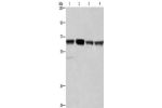 Gel: 6%SDS-PAGE, Lysate: 40 