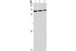 Gel: 12%SDS-PAGE, Lysate: 40 