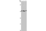 Gel: 10%SDS-PAGE, Lysate: 40 