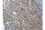 The image on the left is immunohistochemistry of paraffin-embedded Human tonsil tissue using CSB-PA438371(AD7C-NTP Antibody) at dilution 1/25, on the right is treated with synthetic peptide. (Original magnification: 