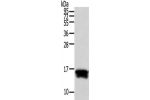 Gel: 12%SDS-PAGE,Lysate: 40 