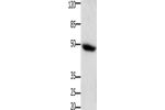 Gel: 10+12%SDS-PAGE, Lysate: 30 