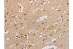 The image on the left is immunohistochemistry of paraffin-embedded Human brain tissue using CSB-PA445592(CDKN2A Antibody) at dilution 1/60, on the right is treated with synthetic peptide. (Original magnification: 