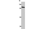Gel: 8%SDS-PAGE, Lysate: 40 