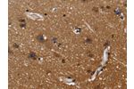 The image on the left is immunohistochemistry of paraffin-embedded Human brain tissue using CSB-PA448974(FGFR1OP Antibody) at dilution 1/40, on the right is treated with fusion protein. (Original magnification: 