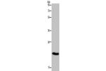Gel: 12+15%SDS-PAGE, Lysate: 40 