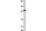 Gel: 10%SDS-PAGE, Lysate: 30 