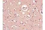 Immunohistochemistry of paraffin-embedded human brain tissue using CSB-PA450719LA01HU at dilution of 1:100