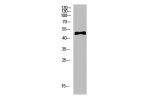 Western Blot analysis of hela cells using primary antibody diluted at 1:500(4