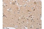 The image on the left is immunohistochemistry of paraffin-embedded Human brain tissue using CSB-PA472830(BUB1 Antibody) at dilution 1/50, on the right is treated with fusion protein. (Original magnification: 