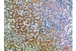 Immunohistochemical analysis of paraffin-embedded human-liver, antibody was diluted at 1:200