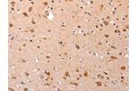 The image on the left is immunohistochemistry of paraffin-embedded Human brain tissue using CSB-PA478144(GATA6 Antibody) at dilution 1/35, on the right is treated with synthetic peptide. (Original magnification: 