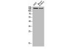 Western blot analysis of K562 3T3 lysate, antibody was diluted at 500. Secondary antibody  was diluted at 1:20000