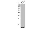 Western blot analysis of mouse-kidney lysis using CCL27 antibody. Antibody was diluted at 1:1000. Secondary antibody  was diluted at 1:20000