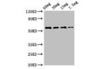 Western Blot<br />
Positive WB detected in Recombinant protein<br />
All lanes:AK antibody at 2.8
