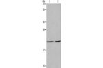 Gel: 8%SDS-PAGE, Lysate: 40 