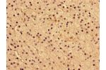 Immunohistochemistry of paraffin-embedded human adrenal gland tissue using CSB-PA516850LA01HU at dilution of 1:100