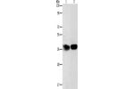 Gel: 12%SDS-PAGE, Lysate: 40 