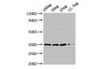 Western Blot<br />
Positive WB detected in Recombinant protein<br />
All lanes:pmp20 antibody at 3.25
