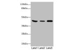 Western Blot<br />
All lanes: B4GALT5 antibody at 8ug/ml<br />
Lane 1 : Mouse heart tissue<br />
Lane 2 : Mouse liver tissue<br />
Lane 3 : Mouse brain tissue<br />
Secondary<br />
Goat polyclonal to rabbit IgG at 1/10000 dilution<br />
Predicted band siz