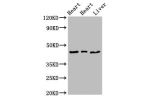 Western Blot<br />
Positive WB detected in:Rat heart tissue,Mouse heart tissue,Mouse liver tissue<br />
All lanes:ECI2 antibody at 2.7