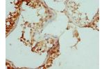 Immunohistochemistry of paraffin-embedded human testis tissue using CSB-PA528588ESR1HU at dilution 1:100