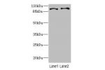 Western blot<br />
All lanes: CCP110 antibody at 4.6ug/ml<br />
Lane 1 : Hela whole cell lysate<br />
Lane 2 : 293T whole cell lysate<br />
 Goat polyclonal to Rabbit IgG at 1/10000 dilution<br />
Predicted band size: 114,112 kDa<br />
Observed band size: