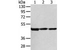 Gel: 8%SDS-PAGE, Lysate: 80 