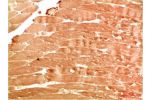 Immunohistochemical analysis of paraffin-embedded Human Skeletal Muscle Tissue using ATG4b Rabbit pAb diluted at 1:200