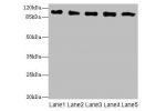 Western blot<br />
All lanes: COPB2 antibody at 2.51ug/ml<br />
Lane 1 : Human placenta tissue<br />
Lane 2 : MCF7 whole cell lysate<br />
Lane 3 : Hela whole cell lysate<br />
Lane 4 : HepG-2 whole cell lysate<br />
Lane 5 : Jurkat whole cell lysate<br /