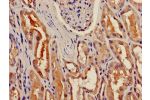 Immunohistochemistry of paraffin-embedded human kidney tissue using CSB-PA530450LA01HU at dilution of 1:100