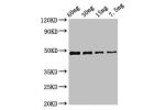 Western Blot<br />
Positive WB detected in Recombinant protein<br />
All lanes:cobB antibody at 2.7