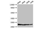 Western Blot<br />
Positive WB detected in Recombinant protein<br />
All lanes:csrA antibody at 3.4