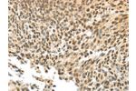 The image on the left is immunohistochemistry of paraffin-embedded Human tonsil tissue using CSB-PA545148(APOL6 Antibody) at dilution 1/60, on the right is treated with synthetic peptide. (Original magnification: 