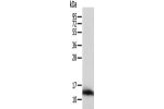 Gel: 12%SDS-PAGE, Lysate: 40 