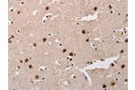The image on the left is immunohistochemistry of paraffin-embedded Human brain tissue using CSB-PA547116(AKAP8L Antibody) at dilution 1/20, on the right is treated with fusion protein. (Original magnification: 