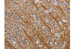 The image is immunohistochemistry of paraffin-embedded Human brain tissue using CSB-PA547318(ABL1 Antibody) at dilution 1/40. (Original magnification: 200)