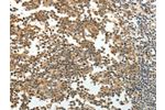 The image on the left is immunohistochemistry of paraffin-embedded Human tonsil tissue using CSB-PA548192(GRK4 Antibody) at dilution 1/30, on the right is treated with fusion protein. (Original magnification: 