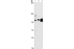 Gel: 8%SDS-PAGE, Lysate: 40 