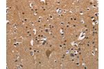 The image on the left is immunohistochemistry of paraffin-embedded Human brain tissue using CSB-PA551448(APOA1 Antibody) at dilution 1/25, on the right is treated with fusion protein. (Original magnification: 