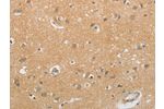 The image on the left is immunohistochemistry of paraffin-embedded Human brain tissue using CSB-PA551964(GJB6 Antibody) at dilution 1/60, on the right is treated with synthetic peptide. (Original magnification: 