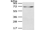 Gel: 10%SDS-PAGE,Lysate: 40 