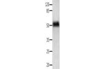 Gel: 10%SDS-PAGE, Lysate: 40 