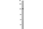 Gel: 10%SDS-PAGE, Lysate: 40 